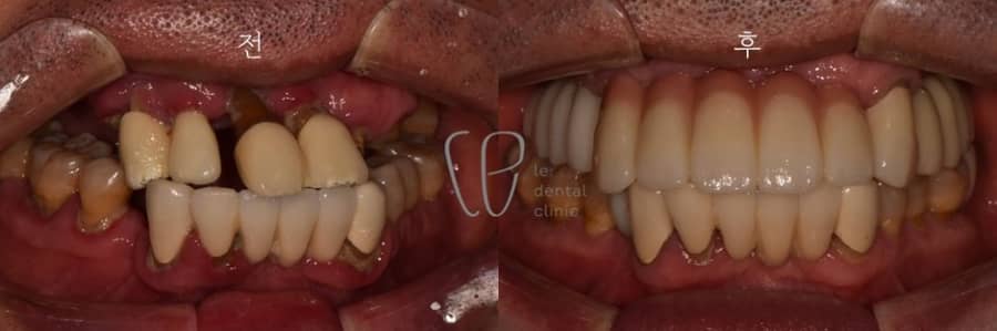 Slider image (2) Le Dental Clinic